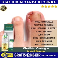 Obat Jamur Kuku Tangan Obat Kuku Bergelombang Kuku Keongan Kuku Tangan Rusak Menghilangkan Jamur Di