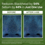 P.CALM Holy Basil Bubble Deep Mask – Holy Basil & Carbonated Water for Cleansing Pores & Blackheads,