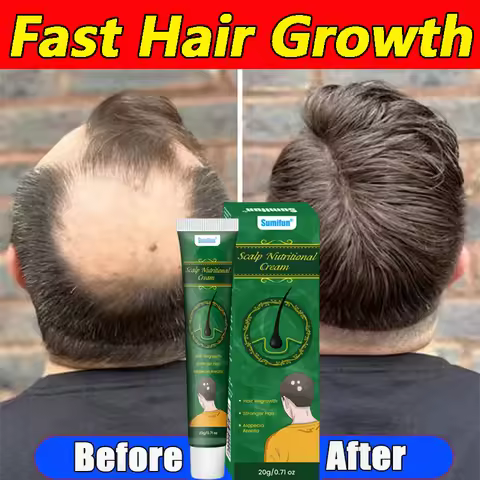 8 Days Fast Hair Growth Cream Anti Hair Loss Prevent Baldness Scalp Treatment Repair Roots Beauty He