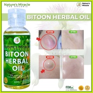 ✤ ∈ Bitoon Herbal Oil Bitoon Oil Original Bitoon Herbal Oil Original Tunaw ang Bukol Goiter Cyst Tu