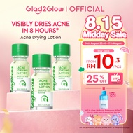 Glad2Glow Acne Drying Lotion Calms Acne Treatment Salicylic Acid Pimple Acne Patch  Scar Dark Spot