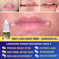NEW Obat Totoaeun, Luka Di Sudut Bibir, Pinggir Mulut Luka, Angular Cheilitis, Bibi Pecah Pecah, Sar