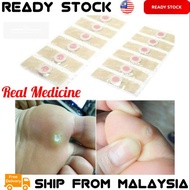 JIYANTIE Paste Foot Corn Plasters [ Remove The Corns ] Paste Clavus Patch Corn Medicated Plaster