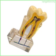 RAN Professional Dental Anatomy Model U6X Enlarged Anatomical Teeth and  Model For Classroom Teachin