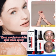 South Moon Vitiligo Remover Spray