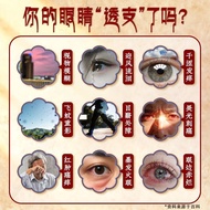 Junsheng Strong Hazy Tablets 0.51g * 9Pcs/Box Junsheng Strong Jade Gallbladder Hazy Tablets Bright E