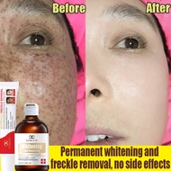whitening dark spot serum krim jeragat anti freckle essence 美白祛斑精华 Lightens facial melanin inhibitio