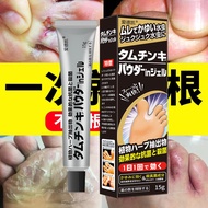 Ointment Athlete's Foot Itching Spray 4.13 Athlete's Foot Agent Spray Remove Anti-Peeling Foot Cream