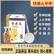 ◈۩◈Toothache Toothache Pain Relief Toothache Ling special effects Nerve irritation Anti-inflammatory