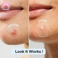 Aosunyuk 210/420Pcs Acne Patch Repair Acne Cleansing Invisible Breathable Acne EN