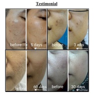 Remdii Nano Face Serum