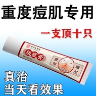 Anti-acne Savior Hong Kong Anti-Acne Cream Moisturizing and抗痘救星香港祛痘膏保湿滋润粉刺痘印青春痘12.23