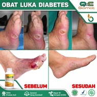 Obat Luka Diabetes Cepat Kering Luka Diabetes di Kaki Luka Diabetes Basah Luka Diabetes Bernanah Luk