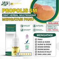 Propolis Ringworm Medicine, Itchy Skin Medicine - Tinea Versicolor - Ringworm - Ringworm - Athlete's