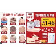 Bioseret Anti- Acne Pimple Cream 10g Prmotion SET B Buy 2 Free 2【 2 Anti- Acne Pimple Cream + 2 Mask