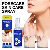 3.47 ReadystockOUHOE Skin Care Spray Clean Skin Gram Warts Fade Dark Moles Corn Smooth Skin Care Spr