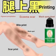 Mosquito Bites Black Marks Black Plain Precipitation Scars Behind Scabs Black Marks Scratches Black 