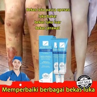 【COD】 ของแท้ ลบรอยแผลเป็น ครีมทาแผลเป็น ครีมลดแผลเป็น scar removal cream ยาทาแผลคีลอยด์ ครีมทาแผลผ่าคลอด ลดแผลไฟไหม้ แผลน้ำร้อนลวก แผลผ่าตัดเป 20g ลบรอยแผลเป็นทั้งหมด เท่า ฮีรูดอย แผลเป็น ความสัมพันธ์ ยาทา ครีมลบ ครีมลด ยาลบ แผบเป็น scar removal cream