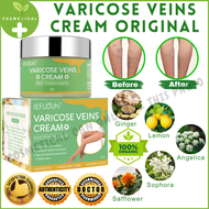 Varicose Vein Cream Remover Pain Reliever SEFUDUN Varicose Veins Remover Cream Treatment for Varicos