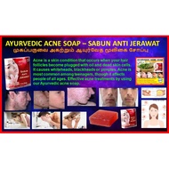 Ayurvedic Acne Bar Soap (100% HANDMADE SOAP)