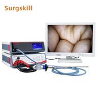 Medical Full HD Endoscope Camera, Laparoscopic Endoscopy Camera 1080P