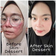 Skin Dessert mosterizer