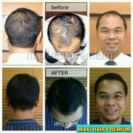 (3box) Vitamin Penumbuh Pelebat Rambut Gugur, Botak, Alopecia, Kelemumur Maxi Hair Premium DHT Block