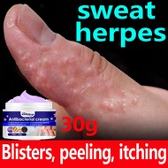 Ready Stock Supply, Relieve Itching, Treat Sweat Acne, Treat Blister, Ointment, GamotSaKatiKatiSaBal