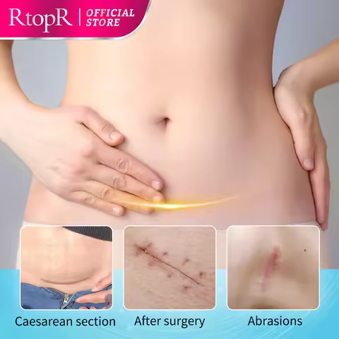 RtopR Mango Skin Cream Whitening and Moisturizing Skin Rejuvenation Nourishing Skin Care