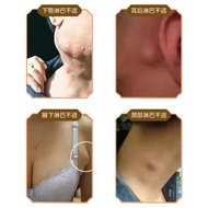 Lymphatic Knots Dispersing Health Care Cream g Lymphatic Swelling Sore Lymphatic Knots Dispersing Cr