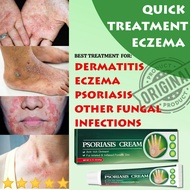 Eczema Treatment Antibacterial Cream Anti Fungal Anti Itch Sweat Herpes Psoriasis Cream 20G