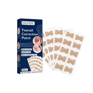 EELHOE Toenail Correction Patch Ingrown Nail Correction Repair Toenail Manicure Patch