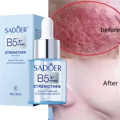 Facial Redness Repair Serum Improve Sensitive Muscles Acne Rosacea Dry&Itchy Skin Moisturizer Lotion