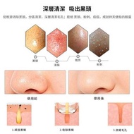 Lunon 吸黑頭粉刺機