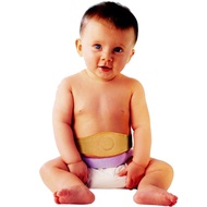 [TYPE 1] Umbilical cord belt supports the treatment of umbilical hernia in newborns DYNA umbilical h