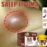 Lipoma Removal Cream Original Lipoma Cream Ubat Benjolan Lipoma Removing Multiple Lipoma Subcutaneou