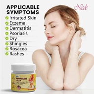 Psoriasis Cream Antifungal cream Eczema cream Cream gatal kulit 20g krim gatal kulit herba cina Ubat