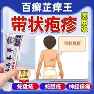 With Herpes Post-Shaped Herpes Neuropathy Snake Plate Herpes Snakes Choleras Snakes Wrapped Waist Sw