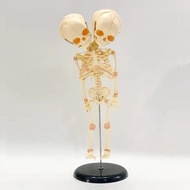 Fetal Fetus Skeleton Anatomy Model Double Head Baby Skull Skeleton Teaching Educational Anatomical M