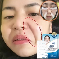 Nasolabial fold patch Anti wrinkle patch Remove nasolabial folds Wrinkle Repair Forehead Wrinkle Smi