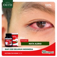 Obat Mata Gatal Alergi Mata Obat Penyakit Konjungtivitis Alergi Okular Iritasi Mata - OilFit 50 Kaps