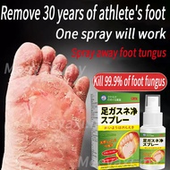 Foot deodorant Anti fungal foot spray Herbal antibacterial spray peeling feet athlete's foot anti-it
