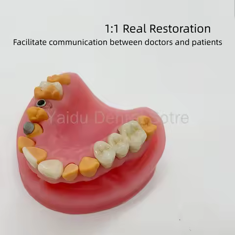 1PC Silicone Dental Restoration Mold Display Inlay Veneer Porcelain Bridge Dental Implant Abutment M