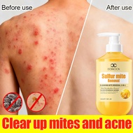 Shower gel, anti-mite shower gel 500ml, sulfur anti-mite shower gel, removes mites, clears acne, ant