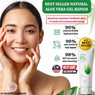 [READY STOCK] 100% Natural Original Aloe Vera Moisturizing Gel For Acne Sunburn And Hair Natural Cream For Body And Skin