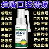 口腔溃疡溃烂喷剂牙龈痛复发性口舌生疮西瓜霜嘴巴上起泡烂Oral ulcer fester spray gum pain recurrence