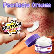 Eczema cream krim gatal antifungal cream psoriasis cream 30g Herbal antibacterial cream eczema relie
