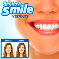 Perfect Smile Veneers (Gigi Palsu) without case