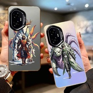 Bayangan api IMD casing for HONOR X9C SMART/HONOR X9B/HONOR X9C/HONOR X9D/HONOR X7C/HONOR X7D/HONOR 