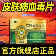 君碧莎 皮肤病血毒片 0.5g*30片/盒 皮肤病血毒片30片清热解毒凉血祛风湿疹荨麻疹皮肤瘙痒促血液循环Junbi Sha Skin Disease Blood Toxin Tablets 0.5g
